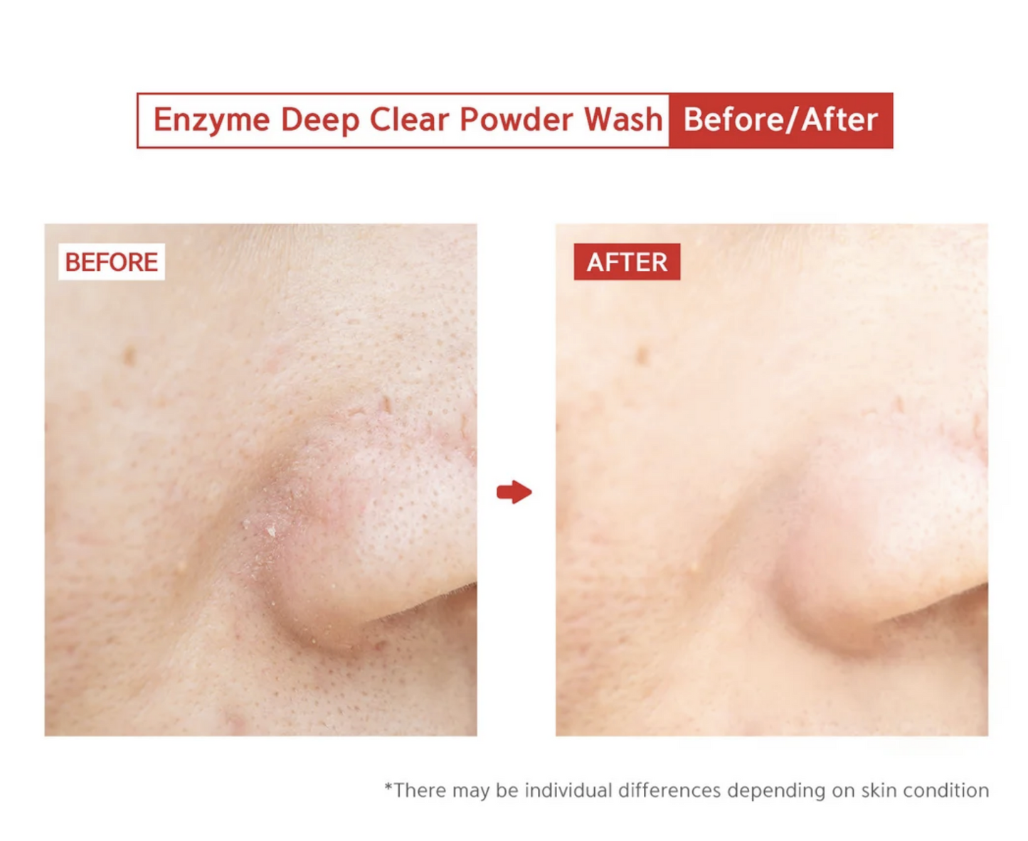 Enzyme Deep Clear Powder Wash